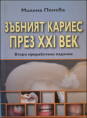 ЗЪБНИЯТ КАРИЕС през XXI век
