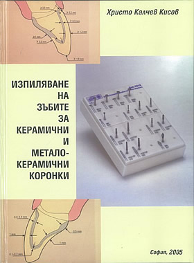 Изпиляване на зъбите за керамични и металокерамични коронки